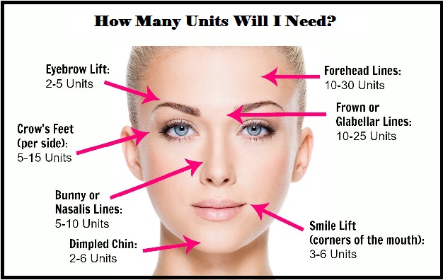 Botox Unit Chart